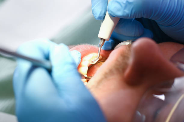 Best Weekend Emergency Dentist in Fredericktown, MO