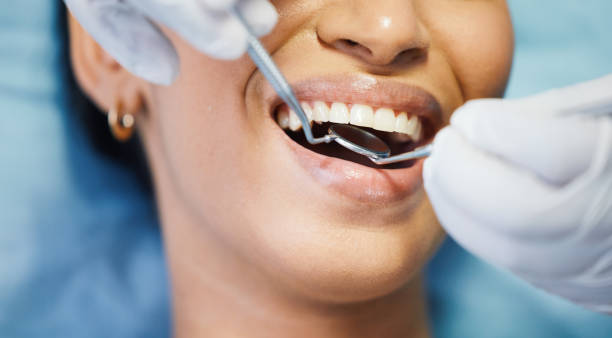 Best Urgent Dental Care in Fredericktown, MO