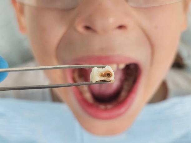Best Emergency Dental Care for Trauma or Injury in Fredericktown, MO